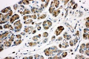 Anti-Kallikrein 1 antibody, IHC(P) IHC(P): Human Pancreatic Cancer Tissue