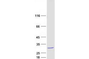Western Blotting (WB) image for Proteasome (Prosome, Macropain) Subunit, beta Type, 9 (Large Multifunctional Peptidase 2) (PSMB9) (Transcript Variant 1) protein (Myc-DYKDDDDK Tag) (ABIN2729954)