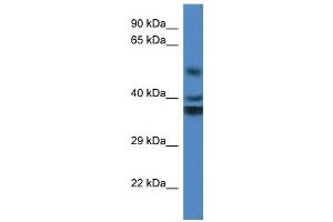 Western Blot showing RTN4IP1 antibody used at a concentration of 1 ug/ml against Fetal Kidney Lysate (RTN4IP1 抗体  (Middle Region))