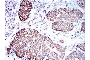 Immunohistochemistry (IHC) image for anti-Keratin 5 (KRT5) (AA 316-590) antibody (ABIN1845567) (Cytokeratin 5 抗体  (AA 316-590))