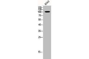 Western Blot analysis of K562 cells using p115 Polyclonal Antibody (USO1 抗体  (C-Term))