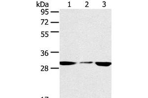 Western Blot analysis of PC3 and hepg2 cell, Human fetal liver tissue using SDHB Polyclonal Antibody at dilution of 1:400 (SDHB 抗体)
