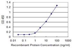 Detection limit for recombinant GST tagged CABP4 is 0. (CABP4 抗体  (AA 1-170))