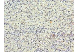 Immunohistochemistry of paraffin-embedded human spleen tissue using ABIN7148893 at dilution of 1:100 (CDKN2D 抗体  (AA 1-166))