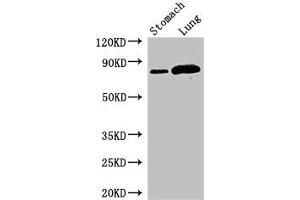 Western Blot Positive WB detected in: Mouse stomach tissue, Rat lung tissue All lanes: SLC3A1 antibody at 2. (SLC3A1 抗体  (AA 1-68))