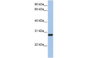 WB Suggested Anti-VDAC3 Antibody Titration: 0. (VDAC3 抗体  (N-Term))