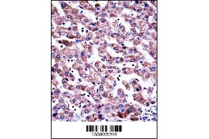 GDI2 Antibody immunohistochemistry analysis in formalin fixed and paraffin embedded human liver tissue followed by peroxidase conjugation of the secondary antibody and DAB staining. (GDI2 抗体  (AA 135-164))