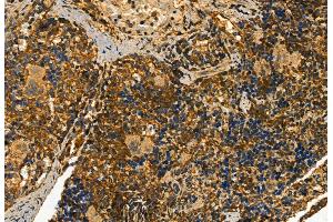 ABIN6258949 and ABIN6273453 at 1/100 staining Rat spleen tissue by IHC-P. (CD81 抗体  (Internal Region))