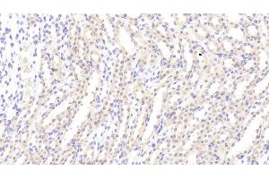 Detection of AXL in Rat Kidney Tissue using Polyclonal Antibody to AXL Receptor Tyrosine Kinase (AXL) (AXL 抗体  (AA 21-202))