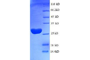 SDS-PAGE (SDS) image for Tu Translation Elongation Factor, Mitochondrial (Tufm) (AA 46-290), (partial) protein (His tag) (ABIN5712213)