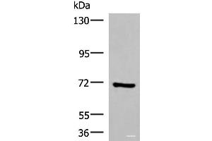 Western blot analysis of HepG2 cell lysate using PAPSS2 Polyclonal Antibody at dilution of 1:1000 (PAPSS2 抗体)