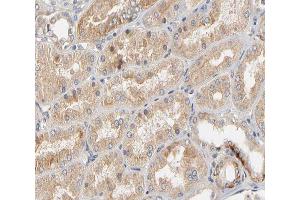 ABIN6266508 at 1/200 staining human kidney tissue sections by IHC-P. (Claudin 2 抗体  (C-Term))