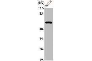 Western Blot analysis of Jurkat cells using Cytokeratin 5 Polyclonal Antibody (Cytokeratin 5 抗体  (C-Term))