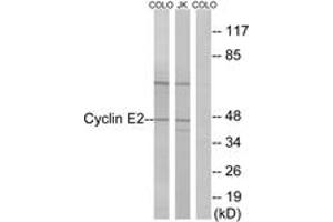 Western blot analysis of extracts from COLO/Jurkat cells, using Cyclin E2 (Ab-392) Antibody. (Cyclin E2 抗体  (AA 355-404))