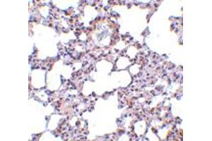 Immunohistochemistry of TRPC6 in mouse lung tissue with TRPC6 polyclonal antibody  at 10 ug/mL . (TRPC6 抗体  (N-Term))