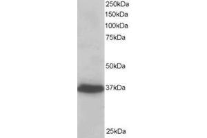 Image no. 1 for anti-PDZ and LIM Domain 4 (PDLIM4) (C-Term) antibody (ABIN374397) (PDLIM4 抗体  (C-Term))