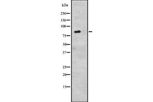 Western blot analysis of CDH6 expression in 293 cell line lysates ,The lane on the left is treated with the antigen-specific peptide. (CDH6 抗体  (C-Term))