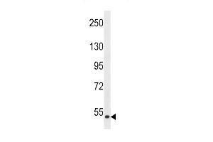 Western blot analysis of anti-MLKLAK- Pab (ABIN392643 and ABIN2842146) in HepG2 cell line lysate (35 μg/lane). (ZAK 抗体  (AA 271-300))