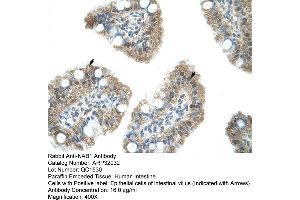 Human Intestine (NAB1 抗体  (N-Term))