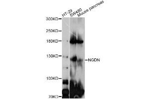 Western blot analysis of extracts of various cell lines, using GUCY2C antibody (ABIN4903854) at 1:1000 dilution. (GUCY2C 抗体)