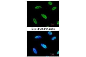 ICC/IF Image Immunofluorescence analysis of paraformaldehyde-fixed HeLa, using DNAJC7, antibody at 1:200 dilution. (DNAJC7 抗体  (Center))