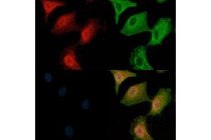 MKK3/MKK6 Antibody staining A549 cells(H2O2 treatment) by IF/ICC. (MAP2K3 抗体)