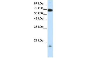 Human 293T; WB Suggested Anti-TRIM32 Antibody Titration: 0. (TRIM32 抗体  (C-Term))