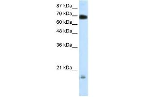 Human 293T; WB Suggested Anti-TRIM32 Antibody Titration: 0.