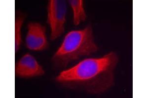 Immunofluorescence staining of methanol-fixed HeLa cells using IKK-β (Phospho-Tyr199) Antibody (E011305, Red) (IKBKB 抗体  (pTyr199))