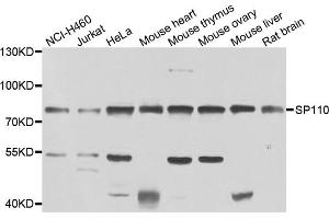 Western blot analysis of extracts of various cell lines, using SP110 antibody (ABIN4905277) at 1:1000 dilution. (SP110 抗体)