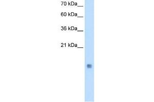 Cystatin B antibody used at 0. (CSTB 抗体)