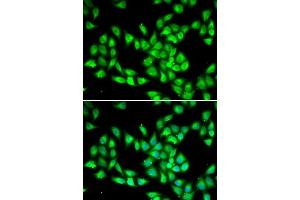 Immunofluorescence analysis of HeLa cells using PCMT1 antibody. (PCMT1 抗体  (AA 62-286))