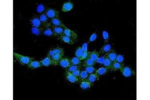 IF analysis of CLDN16/Claudin-16 using anti-CLDN16/Claudin-16 antibody (ABIN7602819). (Claudin 16 抗体  (C-Term))