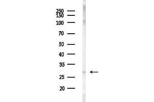 Western blot analysis of lysates from EC304 cells(heat-shock,45 min treatment), using FA Antibody at 1/1000 dilution. (FAM58A 抗体  (Internal Region))