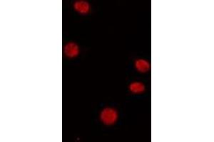 Immunofluorescence (fixed cells) (IF/ICC) image for anti-CREB Binding Protein (CREBBP) (C-Term) antibody (ABIN6260516)