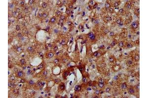 IHC image of ABIN7160839 diluted at 1:500 and staining in paraffin-embedded human liver tissue performed on a Leica BondTM system. (NADK2 抗体  (AA 16-156))