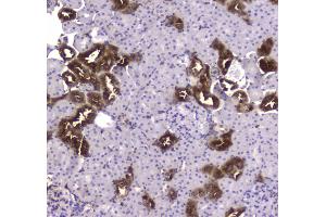 IHC analysis of CKB using anti-CKB antibody . (CKB 抗体  (AA 7-381))