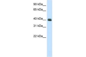 Western Blotting (WB) image for anti-Pseudouridylate Synthase 1 (PUS1) antibody (ABIN2461496) (PUS1 抗体)