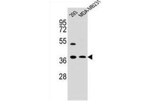 Western Blotting (WB) image for anti-Annexin A2 (ANXA2) (AA 19-49), (N-Term) antibody (ABIN391619)