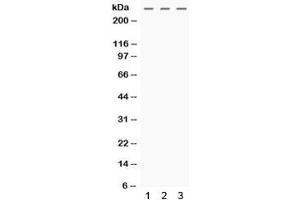 Western blot testing of human 1) HeLa, 2) MCF7 and 3) SW620 cell lysate with MGA antibody. (MGA 抗体)