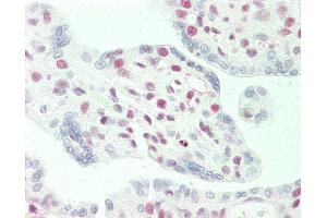 Immunohistochemistry (IHC) image for anti-Stromal Antigen 2 (STAG2) (AA 1125-1175) antibody (ABIN2572749)