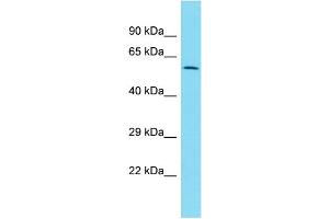Host:  Rabbit  Target Name:  ZNF671  Sample Type:  Uterus Tumor lysates  Antibody Dilution:  1. (ZNF671 抗体  (C-Term))