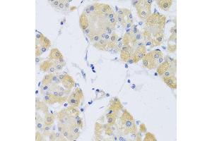 Immunohistochemistry of paraffin-embedded human stomach using CLIP1 antibody at dilution of 1:100 (x40 lens). (CLIP1 抗体)
