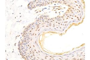 Immunohistochemistry (IHC) image for anti-Receptor tyrosine-protein kinase erbB-2 (ErbB2/Her2) (pTyr1248) antibody (ABIN6256630)