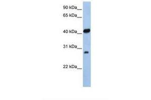 Image no. 1 for anti-Zinc Finger, AN1-Type Domain 3 (ZFAND3) (AA 38-87) antibody (ABIN6737748)