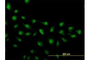 Immunofluorescence of monoclonal antibody to ZIC4 on HeLa cell. (ZIC4 抗体  (AA 249-319))