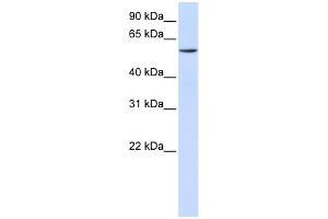 WB Suggested Anti-ZNF358 Antibody Titration: 0. (ZNF358 抗体  (C-Term))