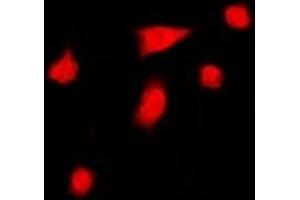 Immunofluorescent analysis of DGK iota staining in HeLa cells. (DGKI 抗体  (C-Term))