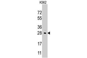Western blot analysis of LIN28B polyclonal antibody  in K-562 cell line lysates (35 ug/lane). (LIN28B 抗体  (Internal Region))
