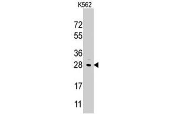 LIN28B 抗体  (Internal Region)